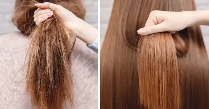 Saç dökülmesinin bir numaralı sebebi - Resim: 4